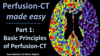 Perfusion CT  made easy - part 1 - Principles of Perfusion CT