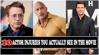 TOP 10 ACTORS INJURIES YOU ACTUALLY SEE IN THE MOVIE | MHS FACTS