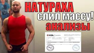 Слил массу внатураху! Мои анализы: натуральная сушка тела без фармподдержки