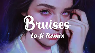 Bruises - Lewis Capaldi ( Nomecy ft.Genavieve Linkowski) / lofi remix
