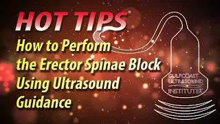 How to Perform the Erector Spinae Block Using Ultrasound Guidance