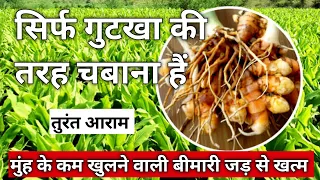oral sub mucous fibrosis treatment in ayurveda,🌳 😘🌳 [osmf treatment in ayurveda]