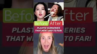 PLASTIC SURGERIES GONE WAY TO FAR!😳 (PART 3)