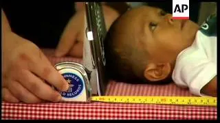 Filipino officially declared world's shortest man