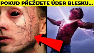 TOP 5 Lidé, Kteří Získali Superschopnosti Po Nehodě