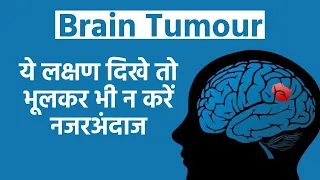 Warning Signs of Brain Tumour: ब्रेन ट्यूमर होने पर इस तरह के लक्षण रोगी के शरीर में नजर आते हैं