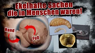 EKELHAFTE Dinge die in MENSCHEN gefunden wurden!