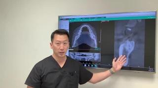 Cant feel your tongue or taste food after wisdom teeth removal?