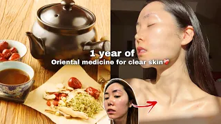 1 Year Skin Transformation W/ Korean Herbal Medicine! The SCIENCE to Glass Skin✨