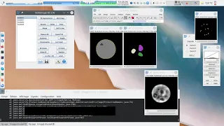 I2K 2020 tutorial: 3D Analysis with the 3D ImageJ Suite (session 1, part 3)