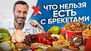 НЕ ЕШЬ ЭТО с брекетами! 10 запрещенных продуктов