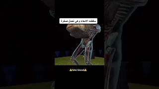 أبشجع الطرق التي توفي بها الناس😔