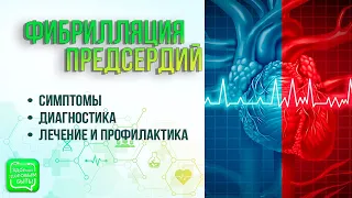 Фибрилляция предсердий | Инсульт как итог фибрилляции предсердий