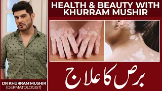 Leucoderma, Vitiligo & Bars Treatment, Beneficial medicines and 100% useful advice by Khurram Mushir