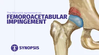 Femoroacetabular Impingement (FAI) Syndrome | SYNOPSIS