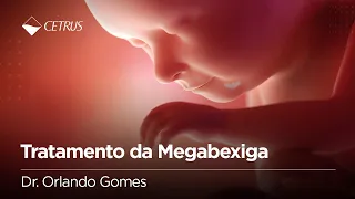 Tratamento da Megabexiga | Dr. Orlando Gomes