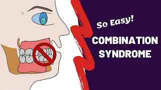 Combination Syndrome in Prosthodontics