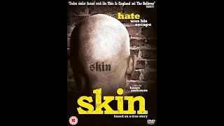 Skin (2008) FULL MOVIE (Subtitulos Español)