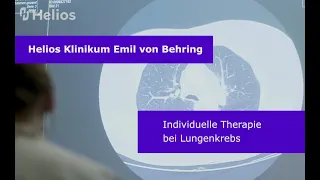 Individuelle Therapie bei Lungenkrebs