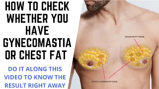 HOW TO KNOW WHETHER YOU HAVE CHEST FAT OR GYNECOMASTIA? DO A TEST NOW AS SHOWN IN THIS VIDEO(SIMPLE)