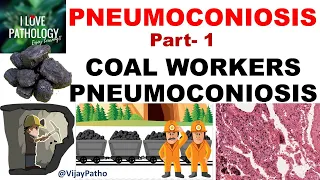 PNEUMOCONIOSIS Part 1: Pathogenesis, Coal workers pneumoconiosis