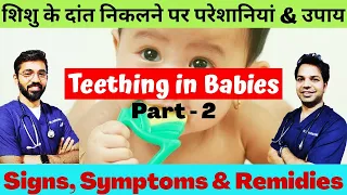 Teething baby: Symptoms, Precautions & Remedies (Part-2)