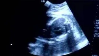 Morgan's ultrasound