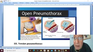 Trauma in Arabic 24 ( Pneumothorax , part 2 ) , by Dr. Wahdan .