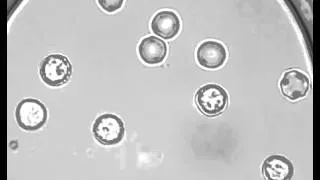 Osmotic burst of blood cells Low