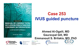 Case 253: Manual of CTO PCI - IVUS guided puncture