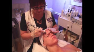 Dermafrac - The painless microneedling