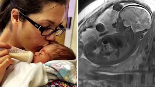 Mutter brachte ein gesundes Baby zur Welt, als die Ärzte ihre Plazenta sahen, ließen sie sie in ihr
