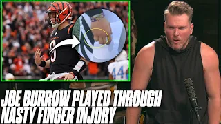 Joe Burrow Played Through Broken Pinky, MASSIVE Swelling Pat McAfee Reacts