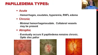 Clinical Grand Rounds in Optic Neuropathies You've Got Some Nerves!