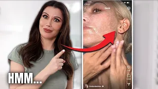 Kim K's Face Lift Scars: Hers VS Mine…