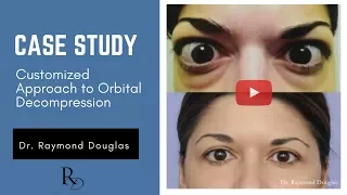 Case Study - Customized Approach to Orbital Decompression