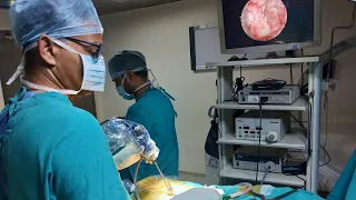 Endoscopic Spine Surgery for L4 - 5 Slipped Disc and Sciatica