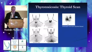 Monday, Thyroid and Parathyroid Scintigraphy, Rodolfo Nuñez