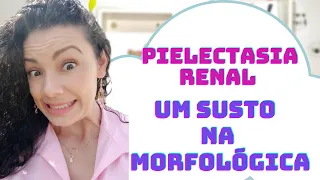 Pielectasia Renal - Um Susto na Ultrassom Morfológica