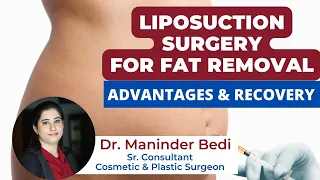 Liposuction ( लिपोसक्शन ) Surgery for Body Fat Removal | Advantages & Recovery | Healing Hospital