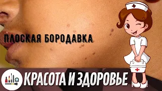 Плоская бородавка