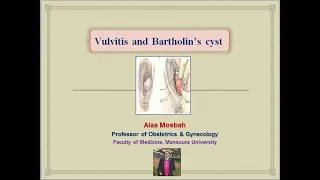 Vulvitis and Bartholin’s cyst