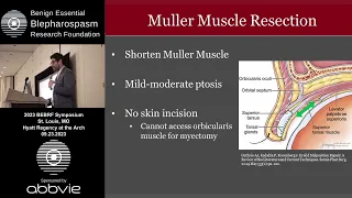 Surgery for Associated Eyelid Malpositions -Robi Maamari, MD