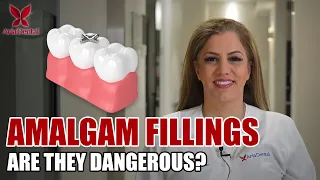 AMALGAM or MERCURY SILVER FILLINGS? | Aria Dental