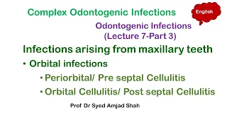 Orbital infections | Periorbital | Orbital Cellulitis | Complex Odontogenic Infections