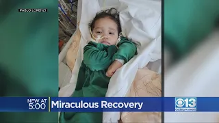Lodi baby declared dead has miraculous recovery