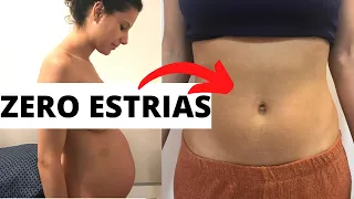 COMO EVITAR ESTRIAS NA GRAVIDEZ | FOTOS DA BARRIGA E PRODUTOS QUE USEI