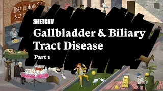 Gallbladder & Biliary Tract Disease (Part 1) | Pathophysiology | Sketchy Medical | USMLE Step 1