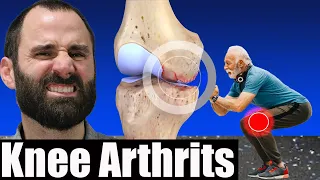 How to Treat Knee (OA) Osteoarthritis l BEST Exercises, Stretches & Treatment for Knee Pain Relief