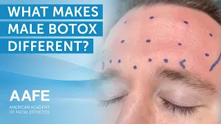 What Makes Male Botox Different?